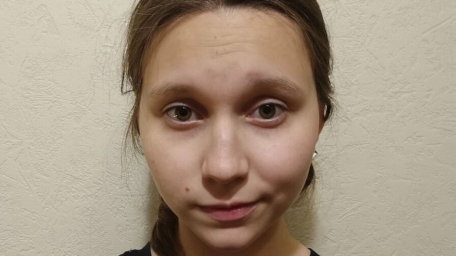 AnhFetsko
